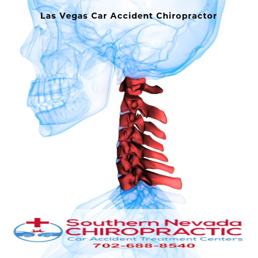 Process of Treatment with a Car Accident Chiropractor - Las Vegas Car Accident Chiropractor Las Vegas